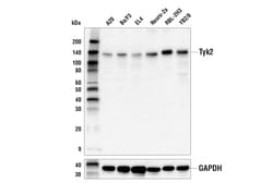 Cell Signaling Technology&nbsp;Tyk2 E9H4T Rabbit mAb 100 ul