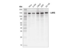 Cell Signaling Technology&nbsp;LARS D7Q4Q Rabbit mAb 100 ul