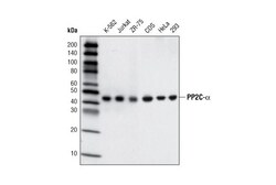 Cell Signaling Technology&nbsp;PP2C-alpha D18C10 XPR Rabb