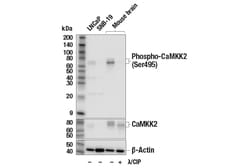 Cell Signaling Technology&nbsp;Phospho-CaMKK2 Ser495 E7W9S