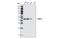 Cell Signaling Technology&nbsp;GATA-1 D52H6 XPR Rabbit mA
