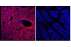 Cell Signaling Technology&nbsp;Arginase-1 D4E3Mtm XPR R