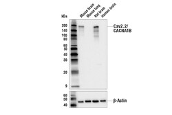 Cell Signaling Technology&nbsp;Cav2.2/CACNA1B Antibody 100 ul