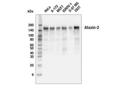 Cell Signaling Technology&nbsp;Ataxin-2 E3B3Z Rabbit mAb 10