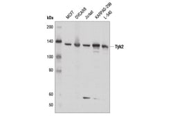 Cell Signaling Technology&nbsp;IFN Type I/III Signaling Pat