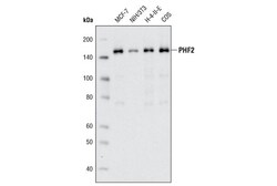 Cell Signaling Technology&nbsp;PHF2 D45A2 Rabbit mAb 20 ul