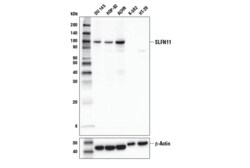 Cell Signaling Technology&nbsp;SLFN11 D8W1B Rabbit mAb 20 u