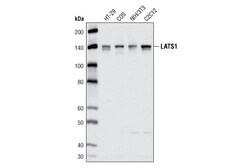 Cell Signaling Technology&nbsp;LATS1 C66B5 Rabbit mAb 20 ul