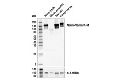 Cell Signaling Technology&nbsp;Neurofilament-M E9N8K Mouse