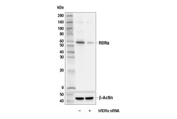 Cell Signaling Technology&nbsp;ROR-alpha E6G5I Rabbit mAb 1