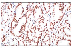 Cell Signaling Technology&nbsp;CBX7 E7N1W Rabbit mAb 100 ul