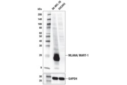 Cell Signaling Technology&nbsp;MLANA/MART-1 Antibody 100 ul