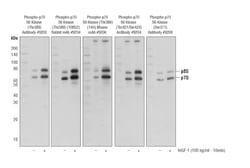 Cell Signaling Technology&nbsp;p70 S6 Kinase MCF7 Control Cel