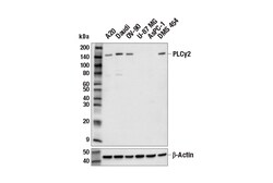 Cell Signaling Technology&nbsp;PLC-gamma-2 E7L6G Rabbit mAb