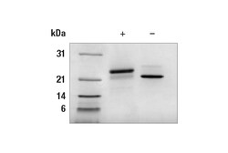 Cell Signaling Technology Human Growth Hormone Recombina
