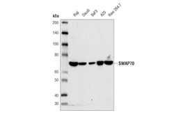 Cell Signaling Technology&nbsp;SWAP70 D5O6A Rabbit mAb 100