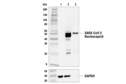 Cell Signaling Technology&nbsp;SARS-CoV-2 Nucleocapsid Protei