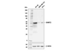Cell Signaling Technology&nbsp;SHMT2 E7F4Q Rabbit mAb 100 u