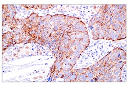 Cell Signaling Technology&nbsp;NPC1 E7S4N Rabbit mAb 100 ul