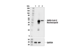 Cell Signaling Technology&nbsp;SARS-CoV-2 Nucleocapsid Protei