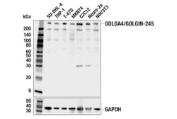 Cell Signaling Technology&nbsp;GOLGA4/GOLGIN-245 E2V6G Rabb