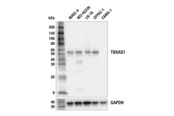 Cell Signaling Technology&nbsp;TBXAS1 F4C5I Rabbit mAb 100