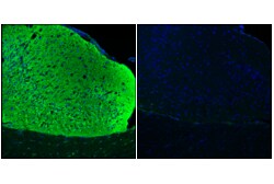Cell Signaling Technology&nbsp;Phospho-Tau Thr205 E9A7P M