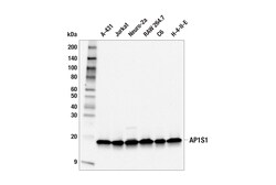Cell Signaling Technology&nbsp;AP1S1 F8K5S Rabbit mAb 100 u