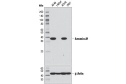 Cell Signaling Technology&nbsp;Annexin A1 D5V2T XPR Rabbi