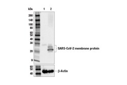 Cell Signaling Technology&nbsp;SARS-CoV-2 Membrane Protein E