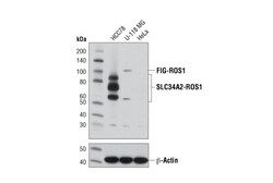 Cell Signaling Technology&nbsp;ROS1 D4D6R Rabbit mAb 20 u