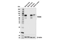 Cell Signaling Technology&nbsp;TRIM9 E5P3R Rabbit mAb 100 u