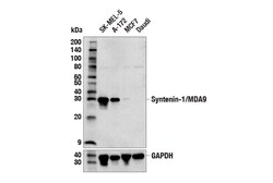 Cell Signaling Technology&nbsp;Syntenin-1/MDA9 E2I9L Rabbit
