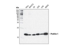 Cell Signaling Technology&nbsp;Profilin-1 C56B8 Rabbit mAb
