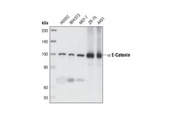 Cell Signaling Technology&nbsp;alpha-E-Catenin 23B2 Rabbit