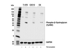Cell Signaling Technology&nbsp;Phospho-beta-Dystroglycan Tyr