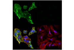 Cell Signaling Technology p75NTR F2L9S Rabbit mAb BSA