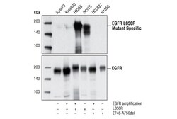 Cell Signaling Technology&nbsp;EGF Receptor L858R Mutant Spe
