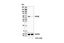 Cell Signaling Technology&nbsp;STK25 E7T2F Rabbit mAb 100 u