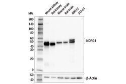 Cell Signaling Technology&nbsp;NDRG1 E2T5I Rabbit mAb 100 u