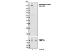Cell Signaling Technology&nbsp;Phospho-PDGF Receptor beta Ty
