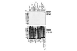 Cell Signaling Technology&nbsp;Phospho-PDGF Receptor beta Ty