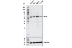Cell Signaling Technology&nbsp;FTO D6Z8W Rabbit mAb 100 ul