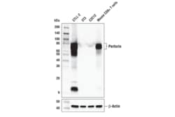 Cell Signaling Technology&nbsp;Perforin E3W4I Rabbit mAb 10