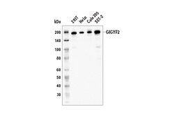 Cell Signaling Technology&nbsp;GIGYF2 E7F7I Rabbit mAb 100