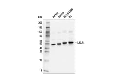 Cell Signaling Technology&nbsp;LYAR E6H1A Rabbit mAb 100 ul