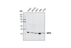 Cell Signaling Technology&nbsp;ARP2 Antibody 20 ul