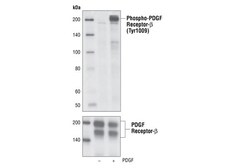 Cell Signaling Technology&nbsp;Phospho-PDGF Receptor beta Ty