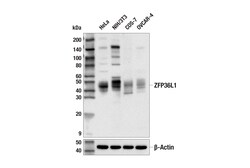 Cell Signaling Technology&nbsp;ZFP36L1 E6L6S Rabbit mAb 100