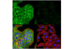 Cell Signaling Technology&nbsp;Liprin alpha-1 E7D7W Rabbit